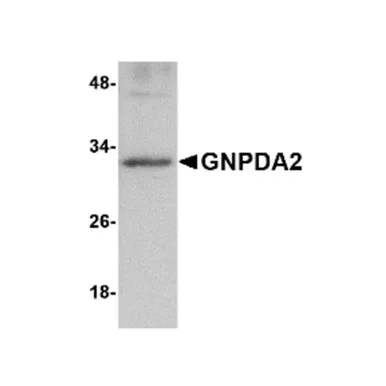 geneseesci20260712081459932455